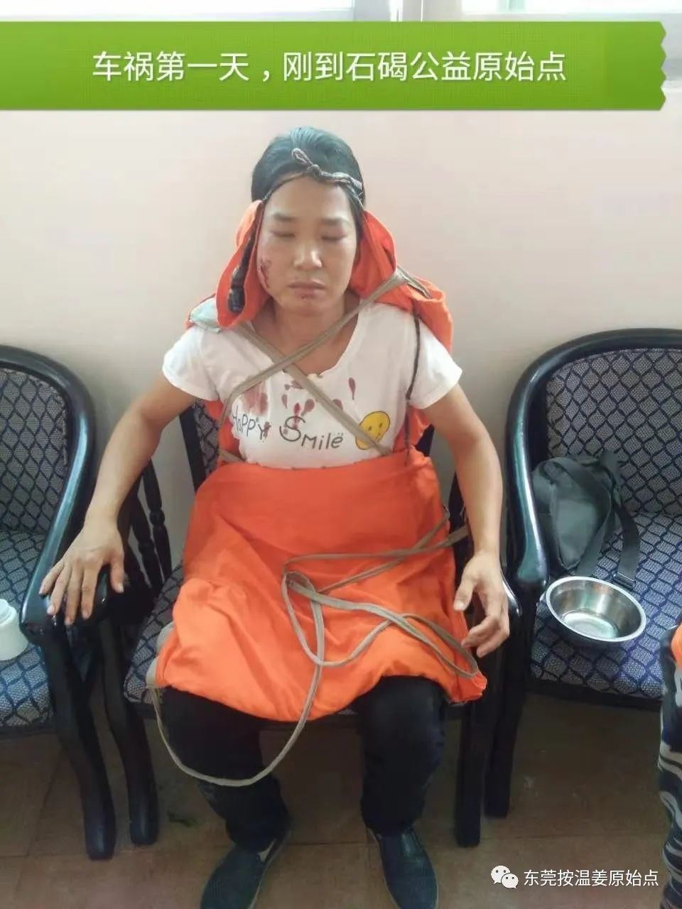 原始點處理肋骨斷7根，胸腔積液等