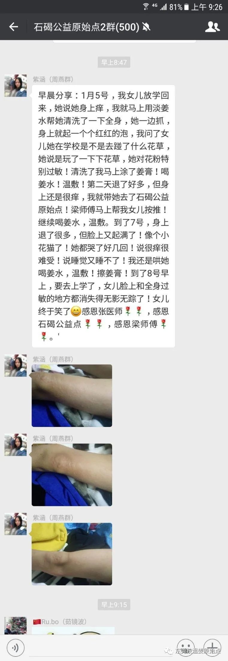 小孩全身過敏