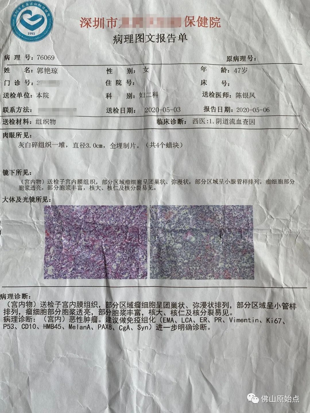 原始點調理子宮惡性腫瘤及全身多處疼痛案例 原始點調理子宮惡性腫瘤及全身多處疼痛案例