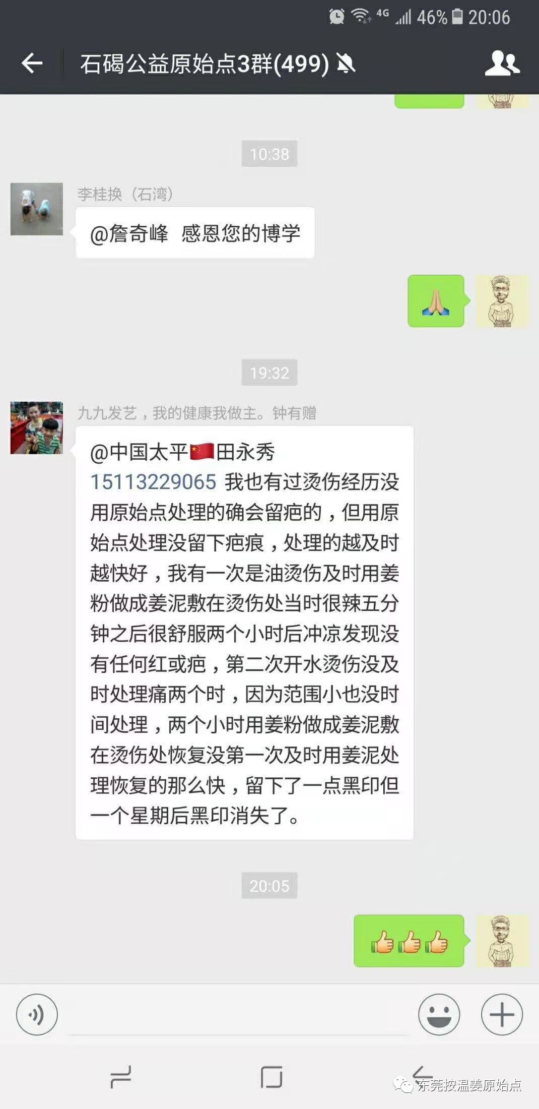 油燙傷，開水燙傷用姜粉處理不留疤