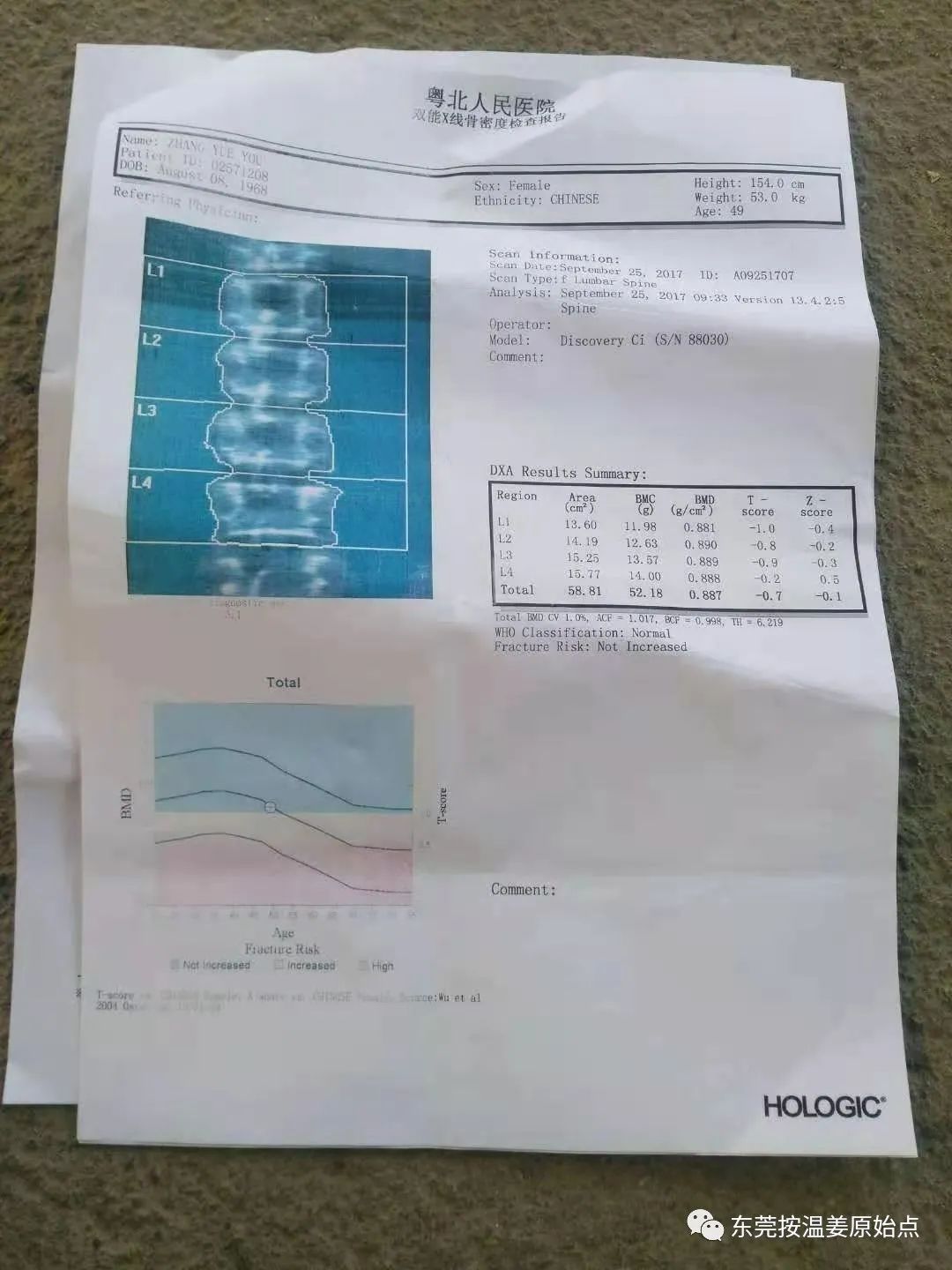 乳腺增生，腰椎間盤突出，骨質增生