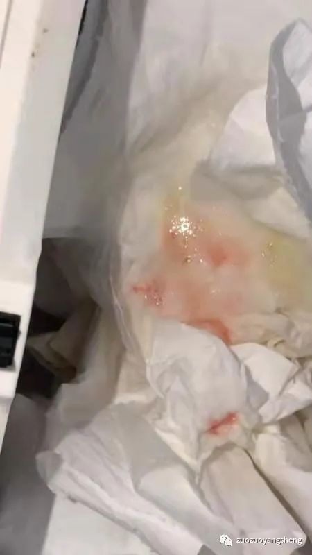 案例分享：原始點調理小孩咳血兩次見效的案例。