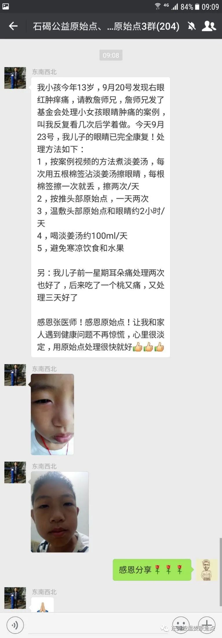 小孩眼睛紅腫，耳朵痛，用原始點自己處理