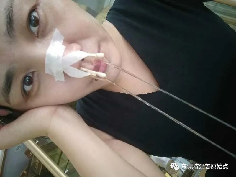 過敏性鼻炎