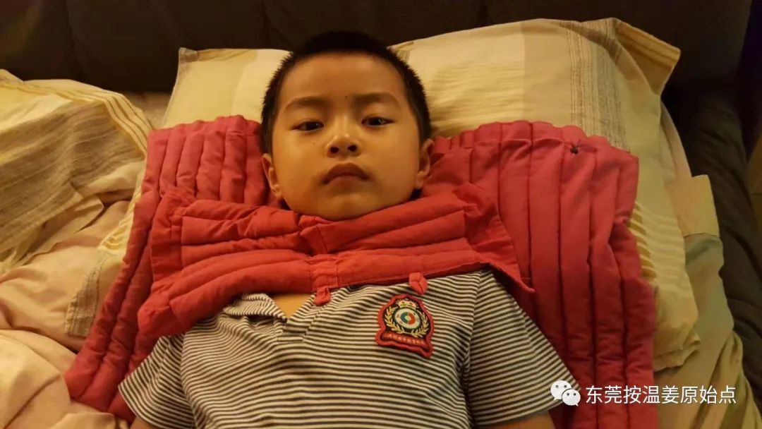 小孩嚴重咳嗽，發燒