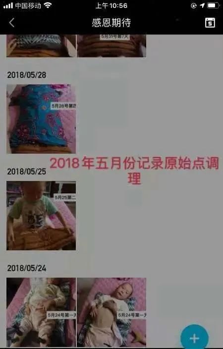 原始點調理腦癱患兒的案例！