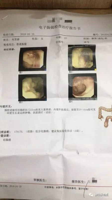 原始點調理結腸癌：命運掌握在自己手中