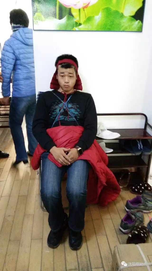 20年癲癇之苦！
