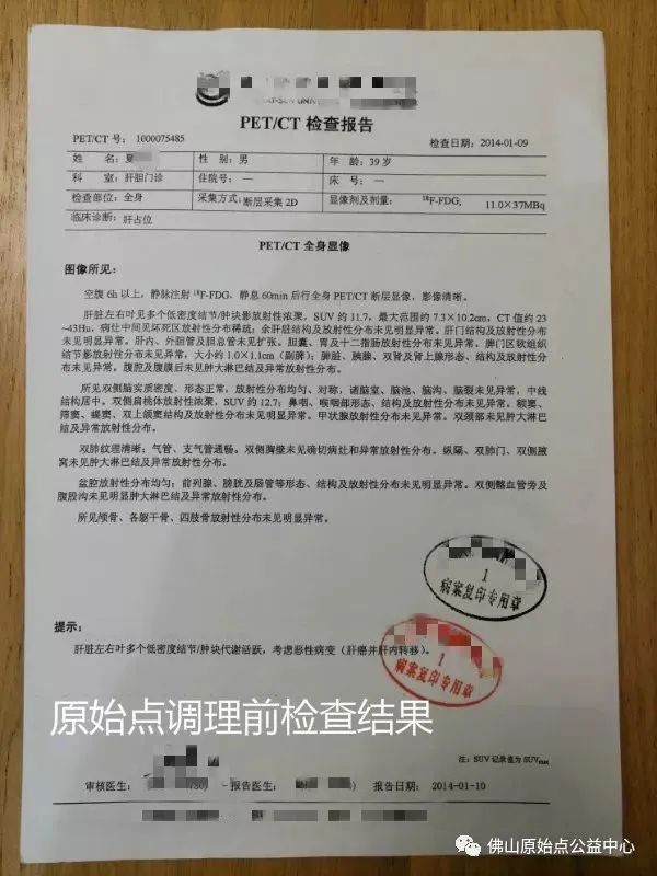 原始點調理肝癌四年后回訪錄:夏先生 原始點調理肝癌四年后回訪錄:夏先生