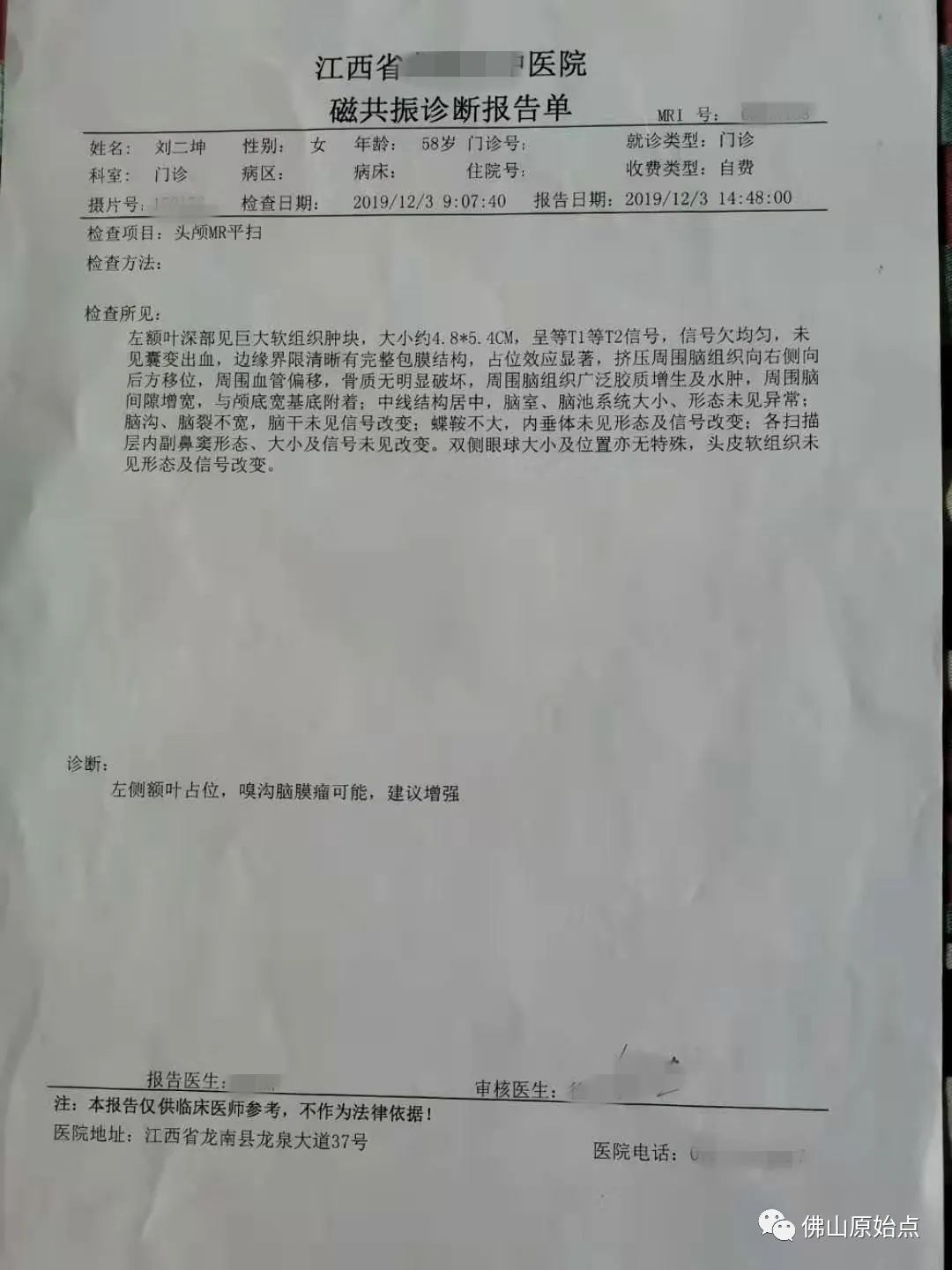 原始點調理腦腫瘤案例
