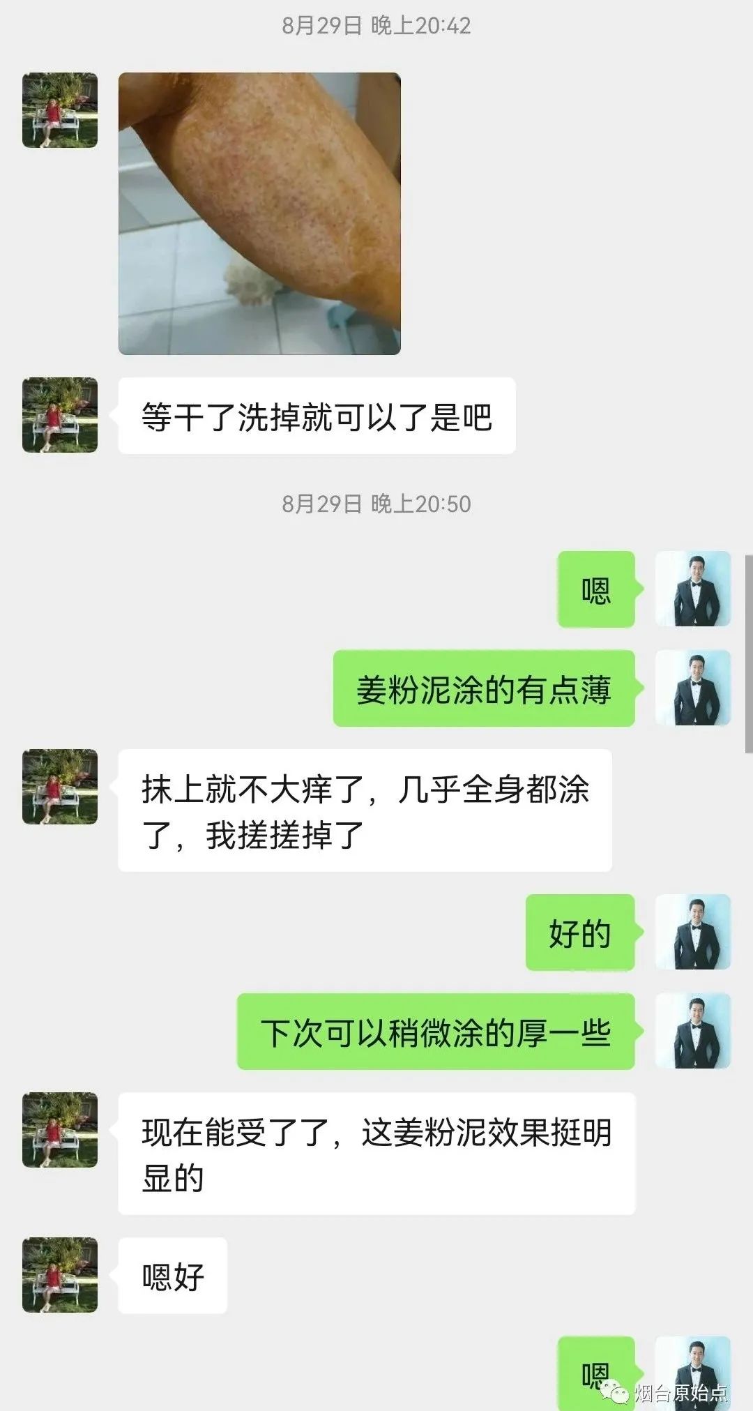 術后藥物引起皮膚過敏案例
