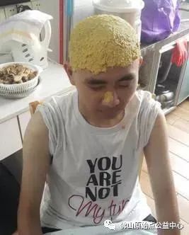 原始點調理九年史牛皮癬：二十天大變化